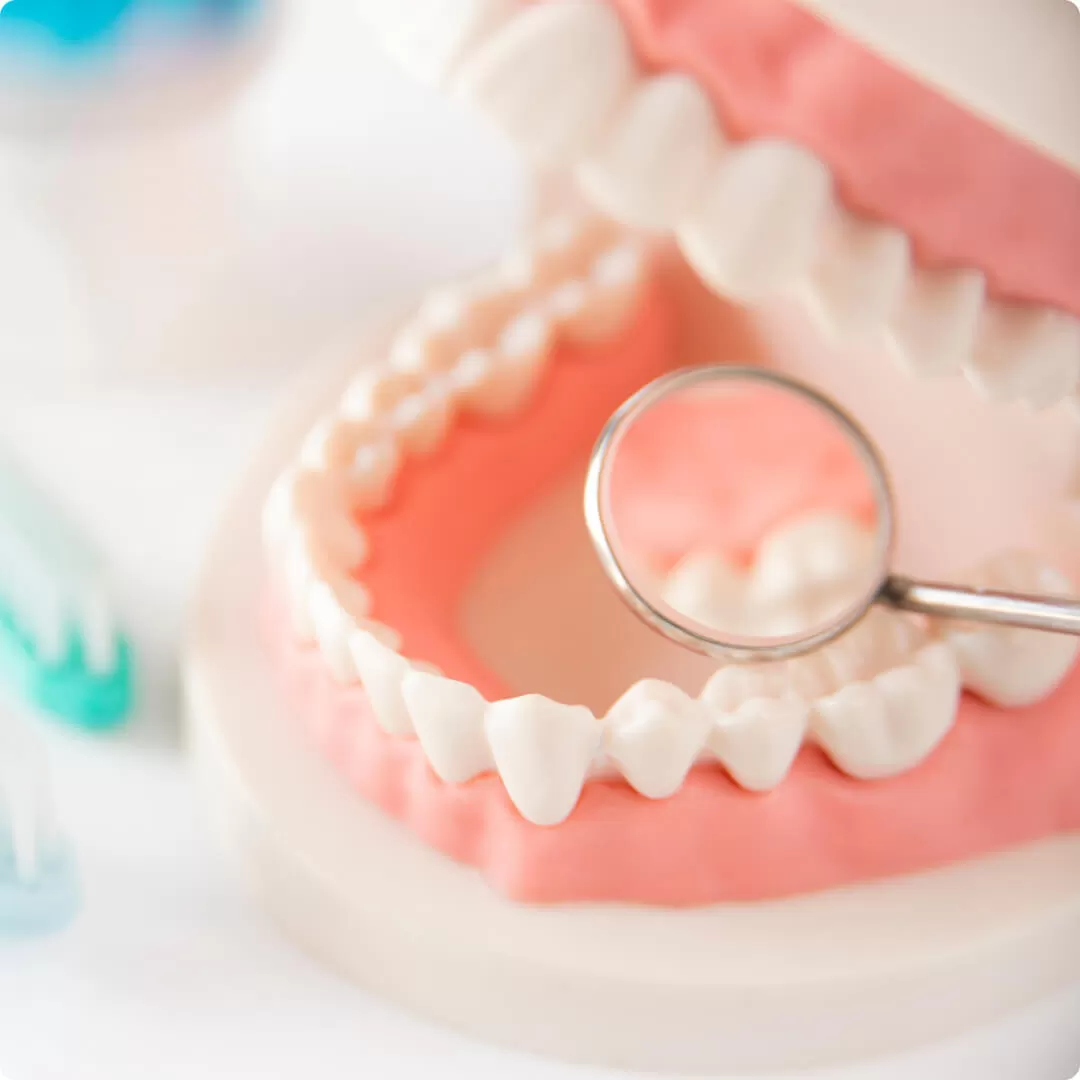 予防メンテナンス